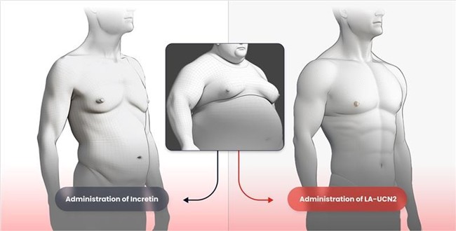 Conceptual illustration of Hanmi’s HM17321 (right), the world’s first obesity drug promoting muscle growth, in comparison with existing incretin-based therapies (left) in obesity treatment efficacy.